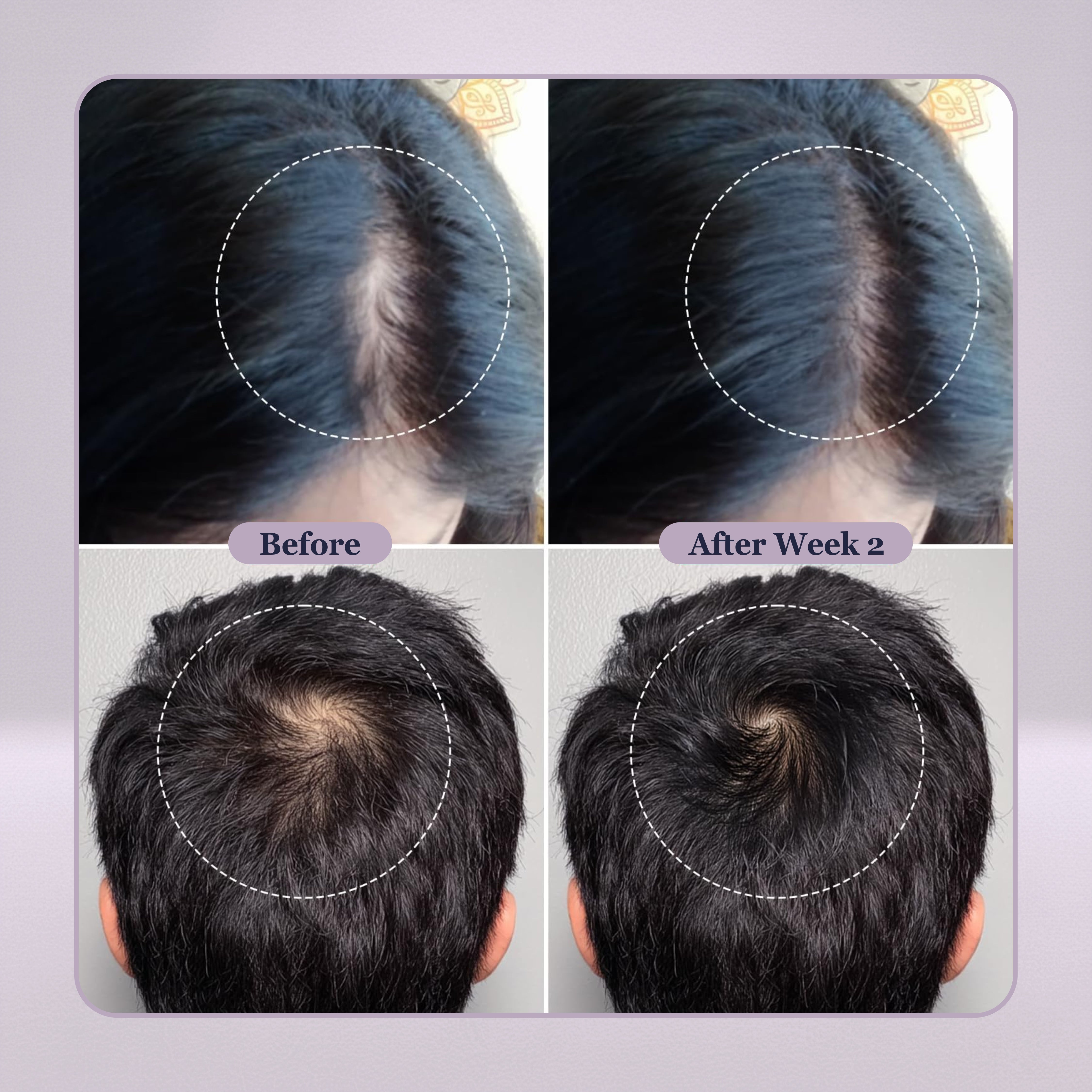 Homeopathic Hair Fall Tonic – 15ml